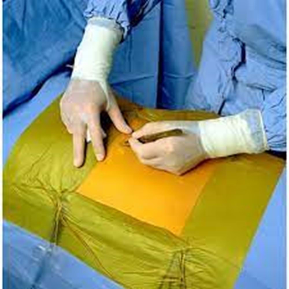 3M Ioban 2 Antimikrobiyal İnsizyon Örtüsü 60X85Cm