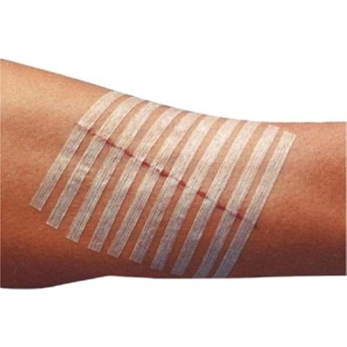 Maxi-Strip Yara Kapatma Şeridi 6.4mm X 102mm